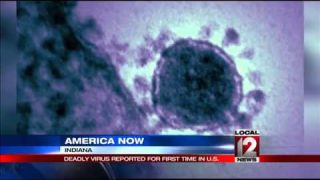 First U.S. case of respiratory coronavirus reported in Ind.