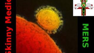 MERS – Middle Eastern Respiratory Syndrome