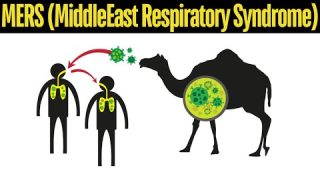 MERS (MiddleEast Respiratory Syndrome) Explained