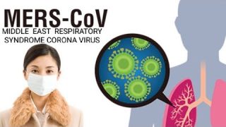 MIDDLE EAST RESPIRATORY SYNDROME