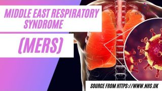 Middle East respiratory syndrome | What are the symptoms of MERS (Middle East Respiratory Syndrome)