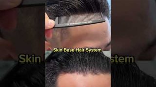 Skin Base Hair Patch System I 100 % Natural Look #hairreplacement #hairsystem