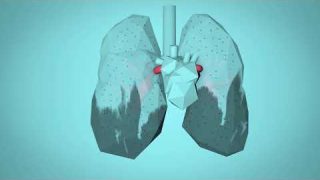 WHO: Breathe Life – How air pollution impacts your body